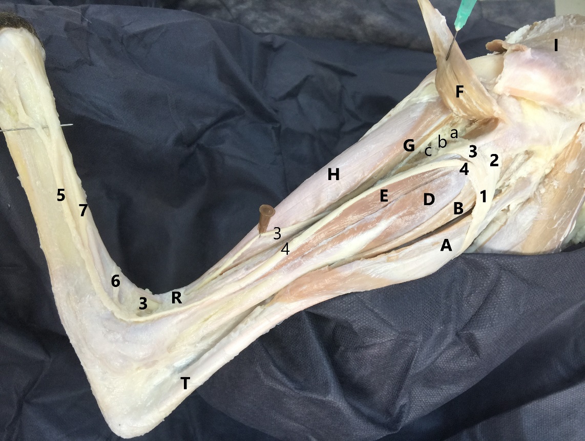 Common peroneal nerve